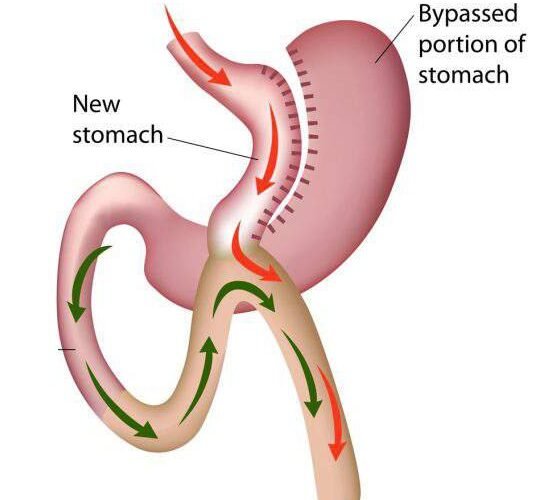 Gastric inhibitory polypeptide GIP and insulin secretion Metabolic hormone Fat storage hormone Diabetes and GIP