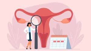 Management of Menstrual Irregularities 